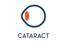 Cataract